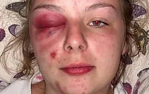 An image Eleanor Williams published in a Facebook post in which she claimed to have been the victim of an Asian grooming gang. The prosecution team says she inflicted the injuries on herself with a hammer